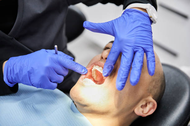Best Emergency Dentist for Lost Fillings or Crowns in Hastings On Hudson, NY
